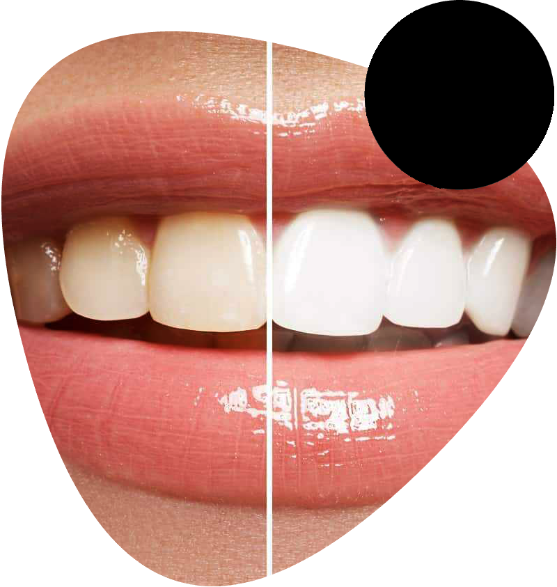 https://www.afyonperiodontolojiuzmani.com.tr/wp-content/uploads/2022/11/img-people-04.png